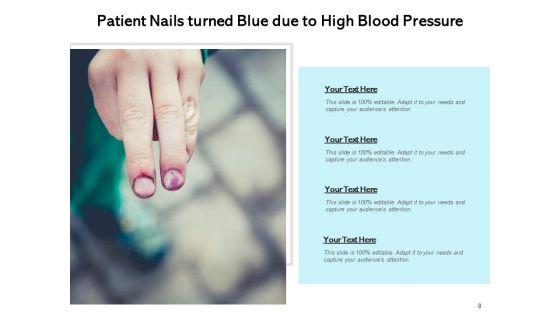 High_BP_Equipment_Blood_Pressure_Ppt_PowerPoint_Presentation_Complete_Deck_Slide_8.jpg