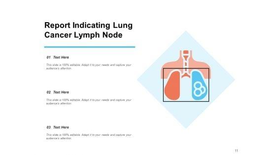 Lung_Carcinoma_Lung_Cancer_Ribbon_Ppt_PowerPoint_Presentation_Complete_Deck_Slide_11.jpg