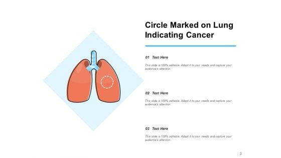 Lung_Carcinoma_Lung_Cancer_Ribbon_Ppt_PowerPoint_Presentation_Complete_Deck_Slide_3.jpg