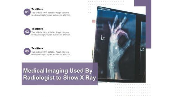 Medical_Imaging_Used_By_Radiologist_To_Show_X_Ray_Ppt_PowerPoint_Presentation_Gallery_Show_PDF_Slide_1.jpg