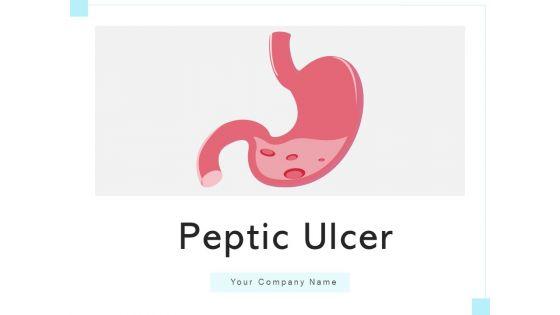 Peptic_Ulcer_Abdomen_Area_Health_Issues_Ppt_PowerPoint_Presentation_Complete_Deck_Slide_1.jpg