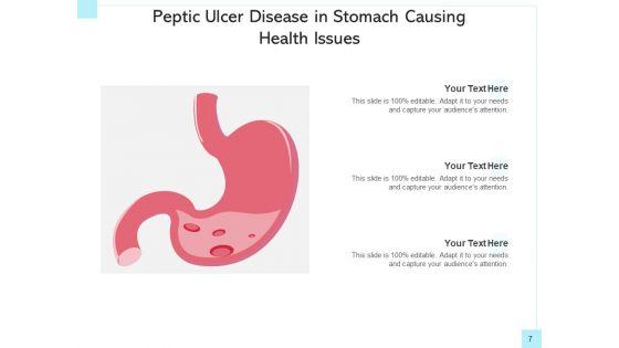 Peptic_Ulcer_Abdomen_Area_Health_Issues_Ppt_PowerPoint_Presentation_Complete_Deck_Slide_7.jpg