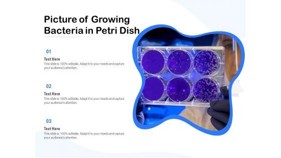 Picture_Of_Growing_Bacteria_In_Petri_Dish_Ppt_PowerPoint_Presentation_Gallery_Graphic_Tips_PDF_Slide_1.jpg