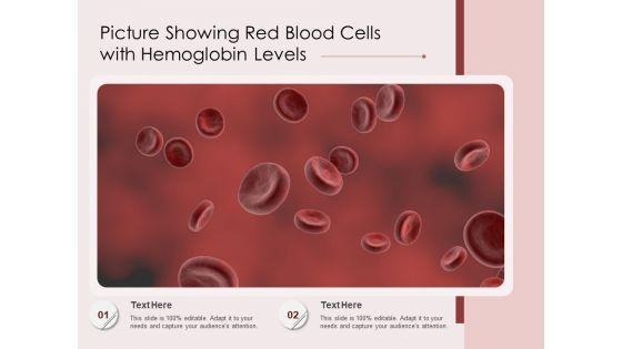 Picture_Showing_Red_Blood_Cells_With_Hemoglobin_Levels_Ppt_PowerPoint_Presentation_File_Templates_PDF_Slide_1.jpg