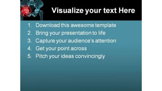 arthritis_in_hip_medical_powerpoint_themes_and_powerpoint_slides_0211_text.jpg