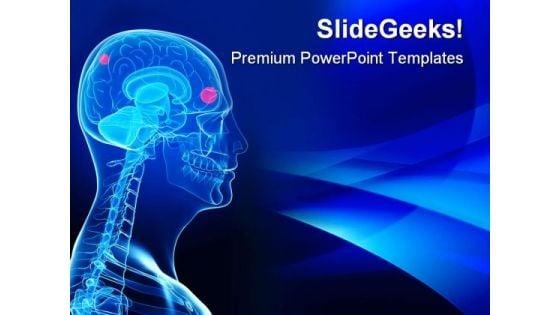 cerebral_tumor_medical_powerpoint_templates_and_powerpoint_backgrounds_0611_title.jpg