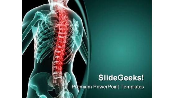 painful_spine_medical_powerpoint_backgrounds_and_templates_1210_title.jpg