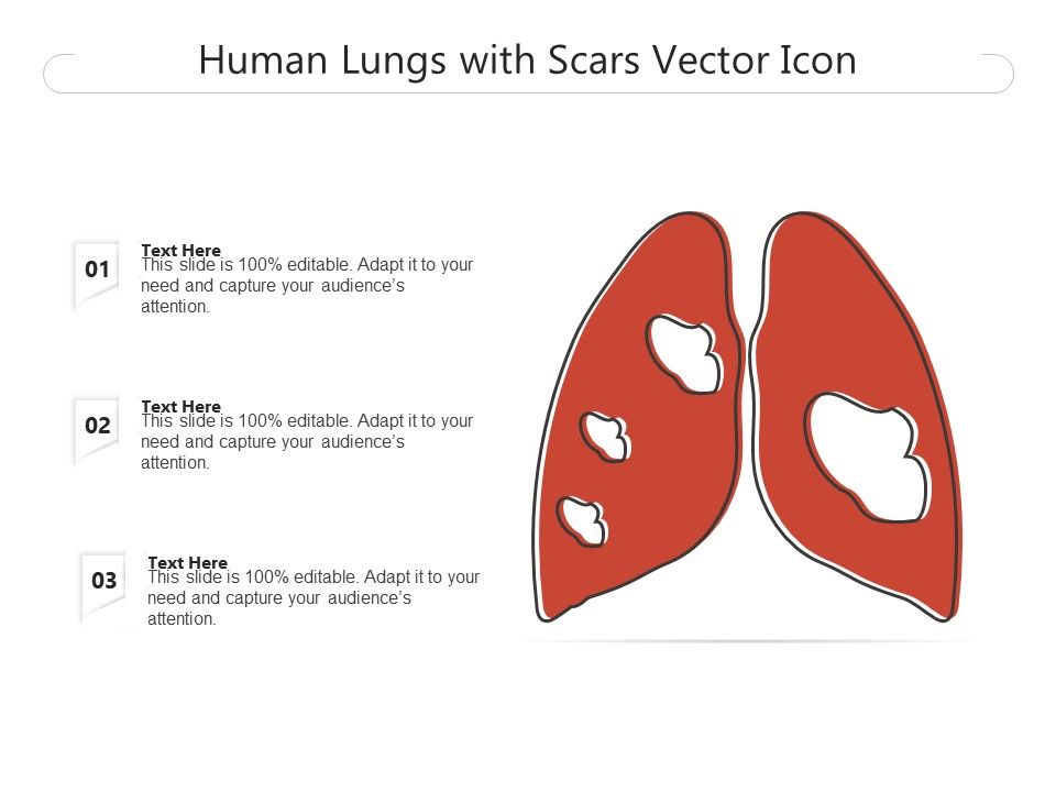 Human_Lungs_With_Scars_Vector_Icon_Ppt_PowerPoint_Presentation_File_Examples_PDF_Slide_1.jpg