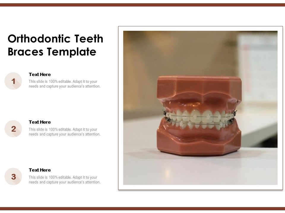 Orthodontic Teeth Braces Template Ppt PowerPoint Presentation Slide PDF