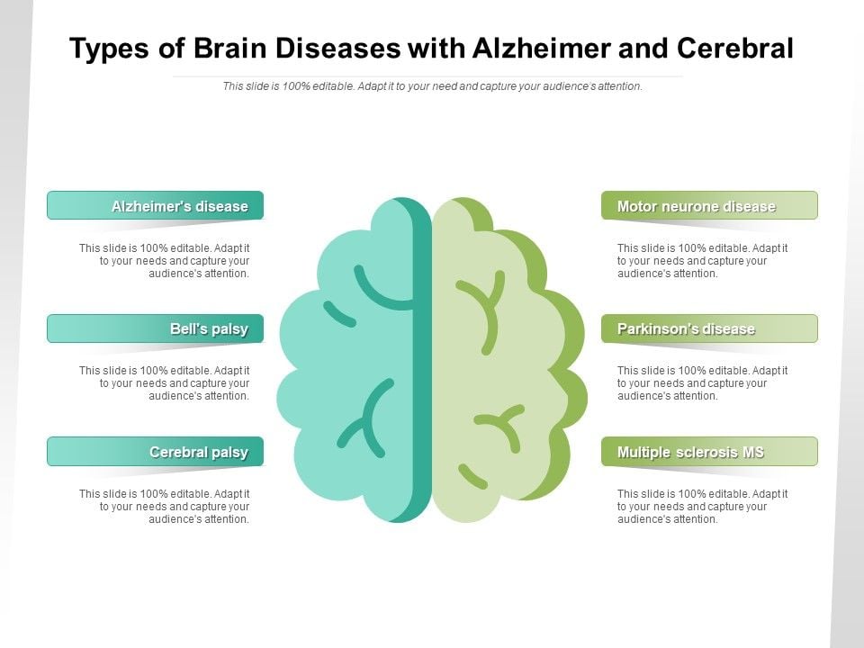 Types_Of_Brain_Diseases_With_Alzheimer_And_Cerebral_Ppt_PowerPoint_Presentation_Icon_Slides_PDF_Slide_1.jpg