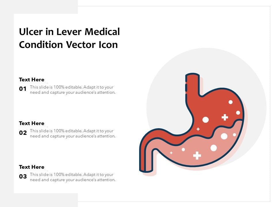Ulcer_In_Lever_Medical_Condition_Vector_Icon_Ppt_PowerPoint_Presentation_Summary_Display_PDF_Slide_1.jpg