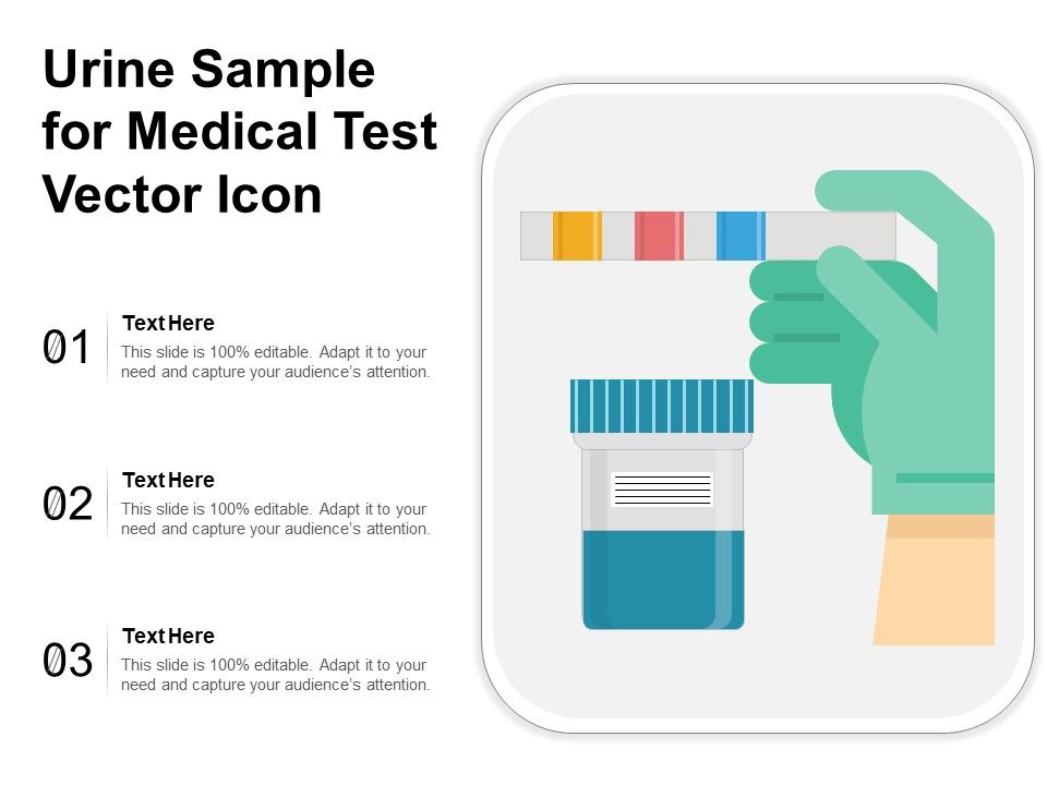 Urine_Sample_For_Medical_Test_Vector_Icon_Ppt_PowerPoint_Presentation_Gallery_Guidelines_PDF_Slide_1.jpg