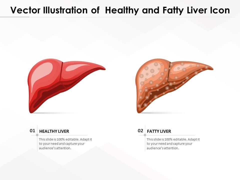 Vector_Illustration_Of_Healthy_And_Fatty_Liver_Icon_Ppt_PowerPoint_Presentation_Gallery_Ideas_PDF_Slide_1.jpg