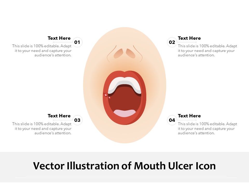 Vector_Illustration_Of_Mouth_Ulcer_Icon_Ppt_PowerPoint_Presentation_Inspiration_Graphics_PDF_Slide_1.jpg