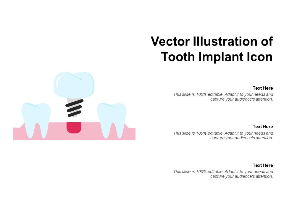 Vector_Illustration_Of_Tooth_Implant_Icon_Ppt_PowerPoint_Presentation_Infographic_Template_Slideshow_PDF_Slide_1.jpg