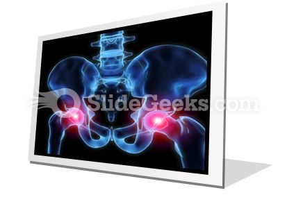 pain_in_hips_powerpoint_icon_f.jpg