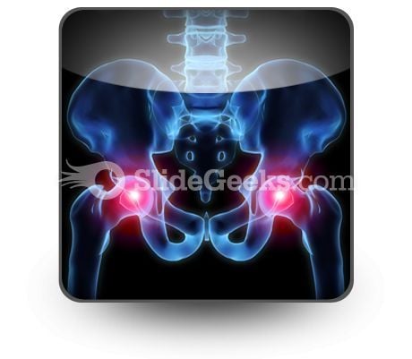 pain_in_hips_powerpoint_icon_s.jpg