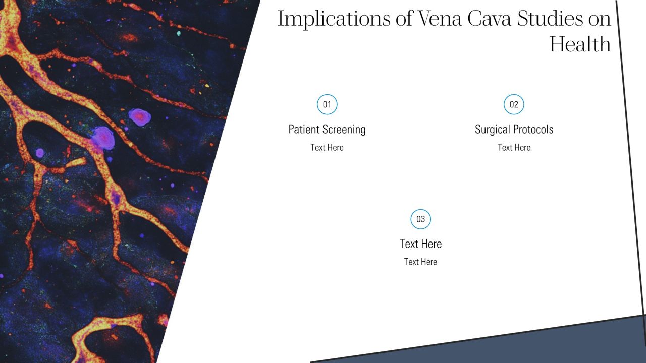 Understanding Vena Cava And Function PPT Example AT Slide22