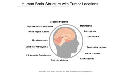 Human Brain Structure With Tumor Locations Ppt Powerpoint Presentation Ideas Example Introduction