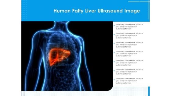 Human Fatty Liver Ultrasound Image Ppt PowerPoint Presentation File Example Topics PDF