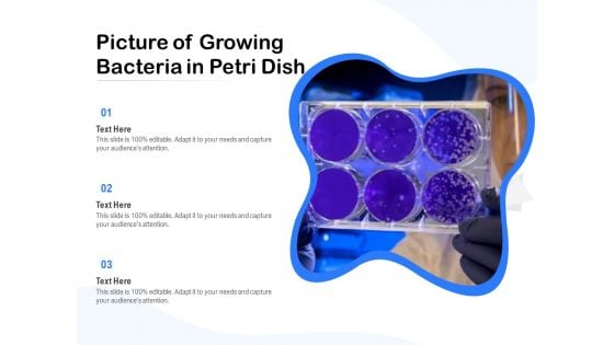 Picture Of Growing Bacteria In Petri Dish Ppt PowerPoint Presentation Gallery Graphic Tips PDF