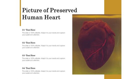 Picture Of Preserved Human Heart Ppt PowerPoint Presentation Professional Smartart PDF