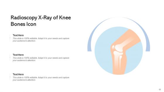 Radioscopy Medical Team Bones Icon Ppt PowerPoint Presentation Complete Deck With Slides