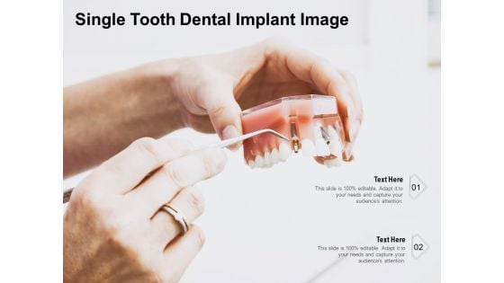 Single Tooth Dental Implant Image Ppt PowerPoint Presentation Model Outfit PDF