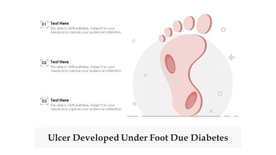 Ulcer Developed Under Foot Due Diabetes Ppt PowerPoint Presentation Pictures Objects PDF