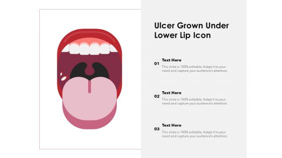 Ulcer Grown Under Lower Lip Icon Ppt PowerPoint Presentation Gallery Show PDF