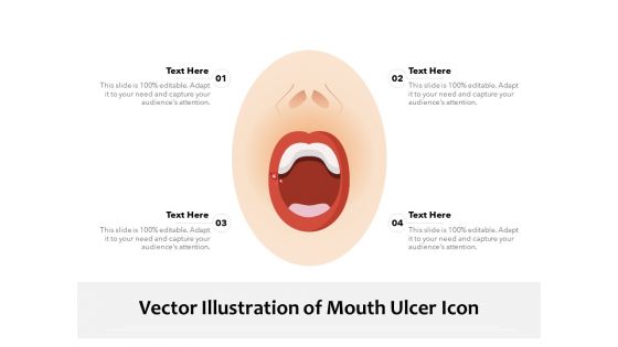 Vector Illustration Of Mouth Ulcer Icon Ppt PowerPoint Presentation Inspiration Graphics PDF