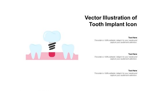 Vector Illustration Of Tooth Implant Icon Ppt PowerPoint Presentation Infographic Template Slideshow PDF