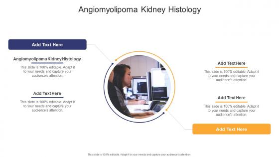 Angiomyolipoma Kidney Histology In Powerpoint And Google Slides Cpb