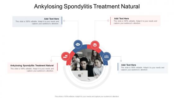 Ankylosing Spondylitis Treatment Natural In Powerpoint And Google Slides Cpb