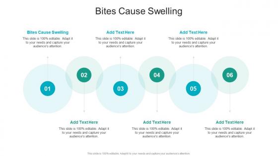 Bites Cause Swelling In Powerpoint And Google Slides Cpb