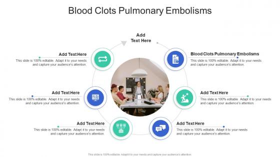 Blood Clots Pulmonary Embolisms In Powerpoint And Google Slides Cpb