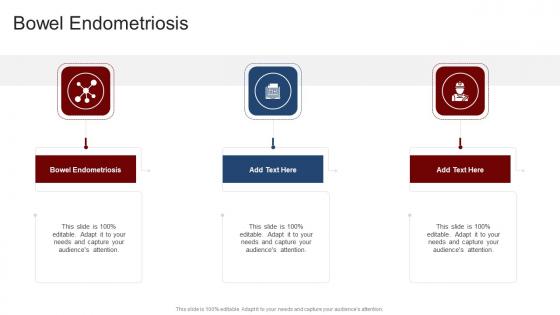 Bowel Endometriosis In Powerpoint And Google Slides Cpb