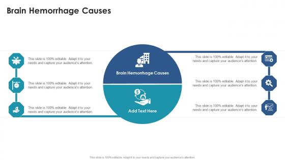 Brain Hemorrhage Causes In Powerpoint And Google Slides Cpb