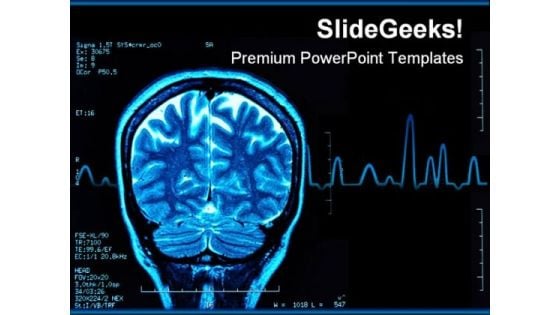 Brain Mri Medical PowerPoint Template 0610