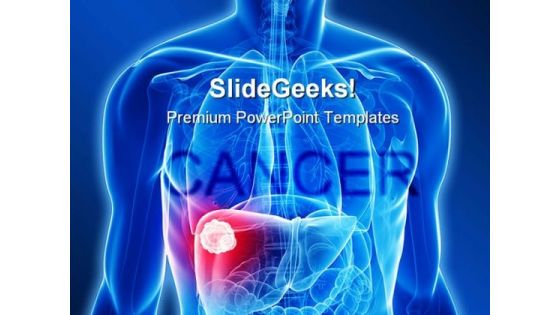 Cancer Medical PowerPoint Template 0610 Cancer Medical PowerPoint Template 0610