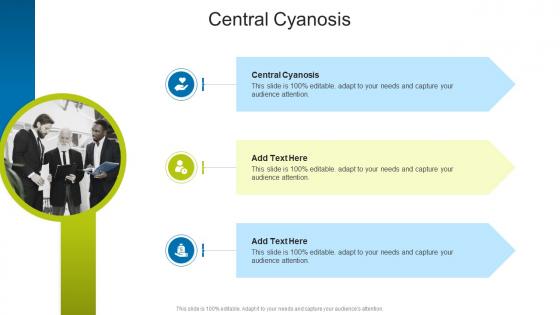 Central Cyanosis In Powerpoint And Google Slides Cpb Central Cyanosis In Powerpoint And Google Slides Cpb