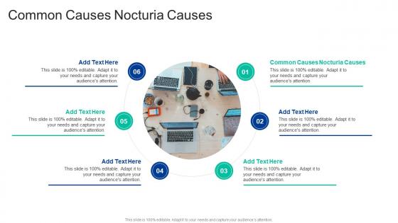 Common Causes Nocturia Causes In Powerpoint And Google Slides Cpb