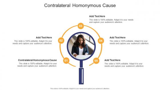 Contralateral Homonymous Cause In Powerpoint And Google Slides Cpb Contralateral Homonymous Cause In Powerpoint And Google Slides Cpb