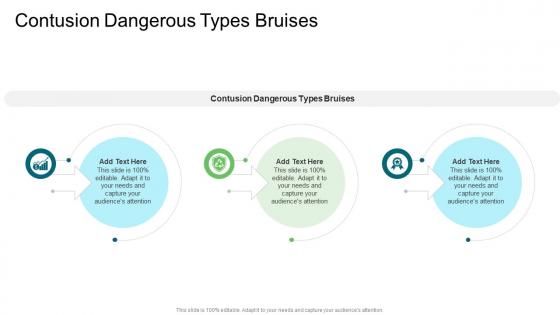Contusion Dangerous Types Bruises In Powerpoint And Google Slides Cpb Contusion Dangerous Types Bruises In Powerpoint And Google Slides Cpb