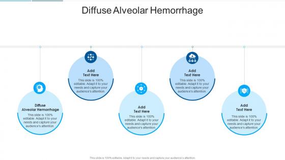 Diffuse Alveolar Hemorrhage In Powerpoint And Google Slides Cpb