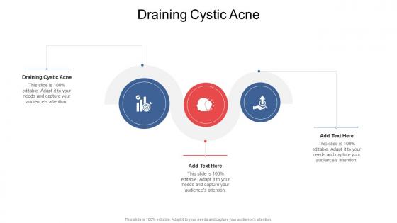 Draining Cystic Acne In Powerpoint And Google Slides Cpb