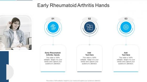 Early Rheumatoid Arthritis Hands In Powerpoint And Google Slides Cpb