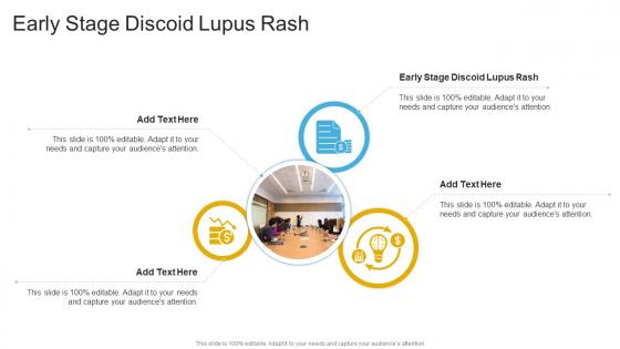 Early Stage Discoid Lupus Rash In Powerpoint And Google Slides Cpb