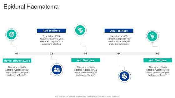 Epidural Haematoma In Powerpoint And Google Slides Cpb