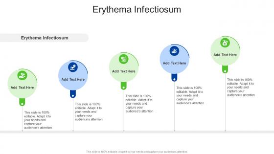 Erythema Infectiosum In Powerpoint And Google Slides Cpb Erythema Infectiosum In Powerpoint And Google Slides Cpb